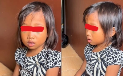 Viral Siswi SD di Palembang Trauma dan Pecah Pembuluh Darah Kedua Mata